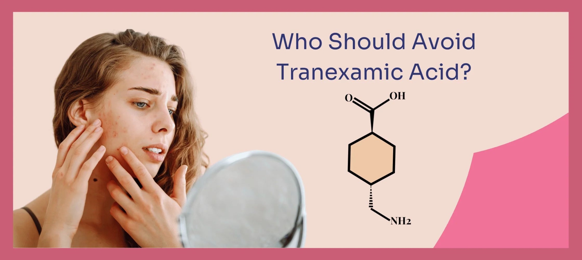 網(wǎng)紅“氨甲環(huán)酸”被批準(zhǔn)用于色斑治療了嗎？